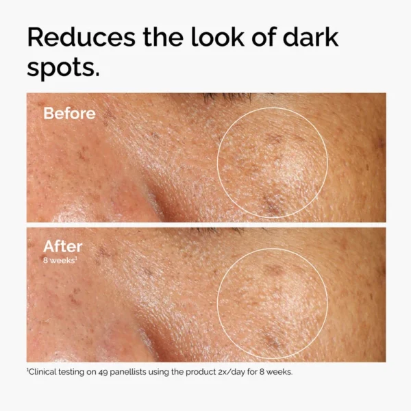 ALPHA ARBUTIN 2% HA SUERO PARA MANCHAS EN LA PIEL THE ORDINARY - Image 2